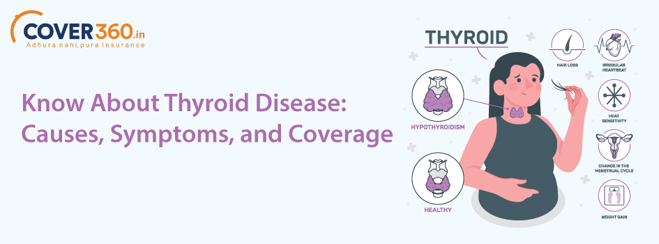 Know-About Thyroid-Disease Causes,